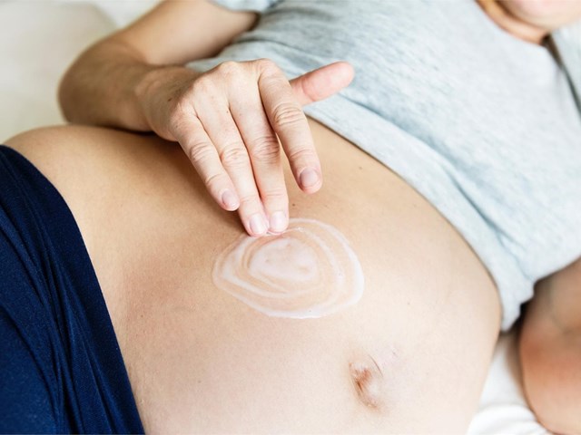 ¿Cómo evitar las estrías en el embarazo?